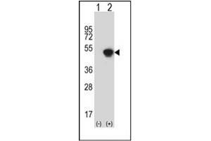 Western blot analysis of GCAT (arrow) using AKB ligase / GCAT Antibody (N-term) Cat. (GCAT Antikörper  (N-Term))