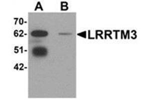 Western blot analysis of LRRTM3 in mouse brain tissue lysate with LRRTM3 antibody at 0.