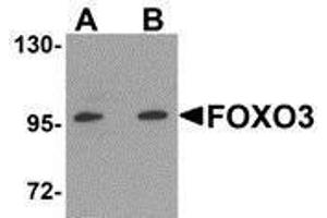 Western Blotting (WB) image for anti-Forkhead Box O3 (FOXO3) (N-Term) antibody (ABIN2473691) (FOXO3 Antikörper  (N-Term))