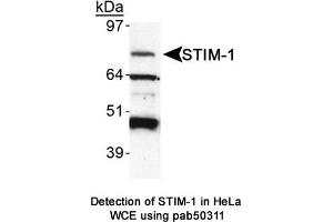 Image no. 1 for anti-Stromal Interaction Molecule 1 (STIM1) (AA 600-685), (C-Term) antibody (ABIN363620) (STIM1 Antikörper  (C-Term))
