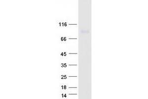 Western Blotting (WB) image for Integrin alpha FG-GAP Repeat Containing 1 (ITFG1) protein (Myc-DYKDDDDK Tag) (ABIN2723877)