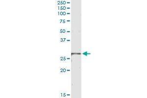 Immunoprecipitation of LRRK1 transfected lysate using anti-LRRK1 monoclonal antibody and Protein A Magnetic Bead , and immunoblotted with LRRK1 MaxPab rabbit polyclonal antibody. (LRRK1 Antikörper  (AA 560-659))