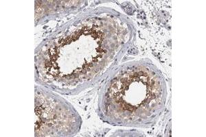 Immunohistochemical staining of human testis with LYZL6 polyclonal antibody  shows strong cytoplasmic positivity in subsets of seminiferus duct cells. (LYZL6 Antikörper)