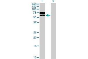 Western Blot analysis of TPP1 expression in transfected 293T cell line by TPP1 MaxPab polyclonal antibody. (TPP1 Antikörper  (AA 1-563))