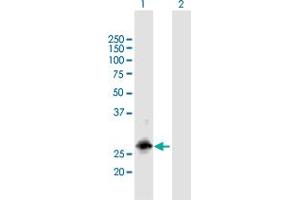 Western Blot analysis of RBM38 expression in transfected 293T cell line by RBM38 MaxPab polyclonal antibody. (RBM38 Antikörper  (AA 1-239))