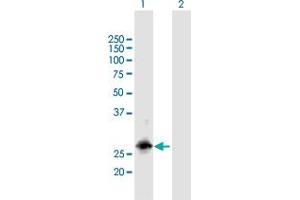 Western Blot analysis of RBM38 expression in transfected 293T cell line by RBM38 MaxPab polyclonal antibody.