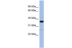 MYD88 antibody used at 1 ug/ml to detect target protein. (MYD88 Antikörper)