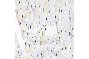Immunohistochemistry of paraffin-embedded rat heart using SF3B3/S Rabbit mAb (ABIN7270544) at dilution of 1:100 (40x lens). (SF3B3 Antikörper)