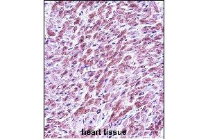 SD3 Antibody (Center) (ABIN657463 and ABIN2846491) immunohistochemistry analysis in forlin fixed and paraffin embedded hun heart tissue followed by peroxidase conjugation of the secondary antibody and DAB staining.