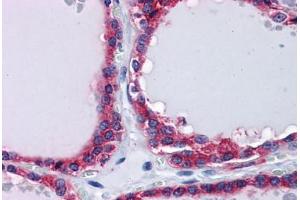 Human Thyroid: Formalin-Fixed, Paraffin-Embedded (FFPE) (PLIN3 Antikörper  (AA 1-435))