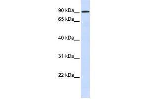 WB Suggested Anti-HKR1 Antibody Titration:  0. (HKR1 Antikörper  (N-Term))
