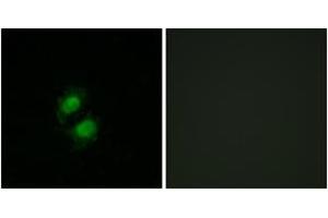 Immunofluorescence analysis of A549 cells, using ZNF95 Antibody.