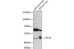 Western blot analysis of extracts of various cell lines, using G antibody (ABIN7267335) at 1:1000 dilution. (GALR2 Antikörper  (AA 50-150))