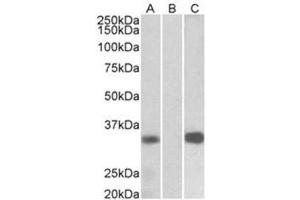 Western Blotting (WB) image for anti-Kv Channel Interacting Protein 3, Calsenilin (KCNIP3) (Internal Region) antibody (ABIN1105646) (DREAM Antikörper  (Internal Region))
