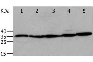 Western Blot analysis of Mouse eyes and heart, Human cervical cancer tissue, OP9 and RAW264. (Annexin V Antikörper)