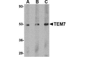Western blot analysis of TEM7 in human liver tissue lysate with this product at (A) 0. (PLXDC1 Antikörper  (C-Term))