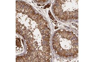 Immunohistochemical staining of human testis with CYB5R3 polyclonal antibody  shows strong cytoplasmic positivity in cells in seminiferus ducts and Leydig cells at 1:1000-1:2500 dilution. (CYB5R3 Antikörper)