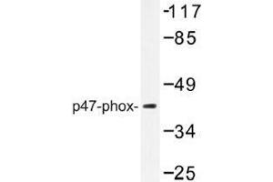 Image no. 1 for anti-Neutrophil Cytosol Factor 1 (NCF1) antibody (ABIN317896) (NCF1 Antikörper)