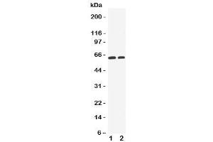 Western blot testing of OCT1 antibody and Lane 1:  HeLa (SLC22A1 Antikörper  (C-Term))