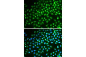 Immunofluorescence (IF) image for anti-SWI/SNF Related, Matrix Associated, Actin Dependent Regulator of Chromatin, Subfamily A, Member 5 (SMARCA5) (AA 100-400) antibody (ABIN3022717) (SMARCA5 Antikörper  (AA 100-400))