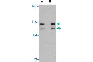 Western blot analysis of SATB1 in SK-N-SH cell lysate with SATB1 polyclonal antibody  at (A) 1 and (B) 2 ug/mL .