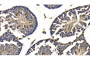 Immunohistochemistry (IHC) image for anti-TNF Receptor-Associated Factor 6 (TRAF6) (AA 153-423) antibody (ABIN7436348)