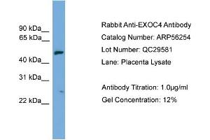 WB Suggested Anti-EXOC4  Antibody Titration: 0. (Sec8 Antikörper  (N-Term))