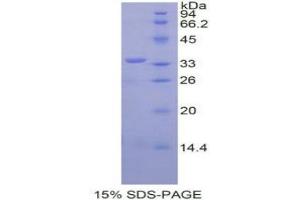 SDS-PAGE analysis of Mouse SPINK5 Protein.