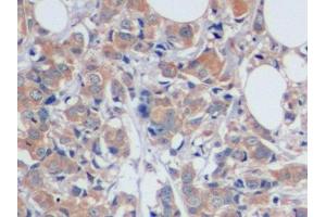 Immunohistochemistry (IHC) image for anti-Mucin 16, Cell Surface Associated (CA125) (AA 13977-14117) antibody (ABIN7431218)