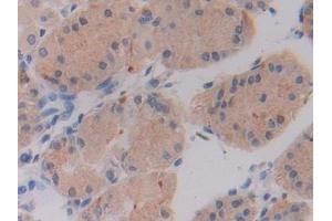 Immunohistochemistry (IHC) image for anti-serine Hydroxymethyltransferase 2 (Mitochondrial) (SHMT2) (AA 30-504) antibody (ABIN7443701)