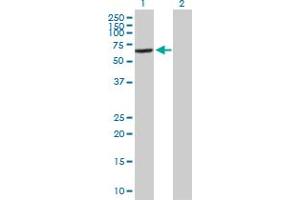 Western Blot analysis of VPS45 expression in transfected 293T cell line by VPS45 MaxPab polyclonal antibody.