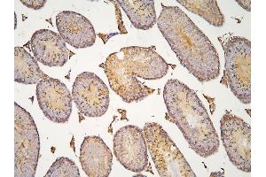 IHC analysis of HOOK3 using anti-HOOK3 antibody (ABIN6719547). (HOOK3 Antikörper  (AA 14-198))