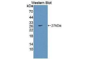 Western blot analysis of the recombinant protein. (PEX1 Antikörper  (AA 172-377))
