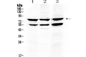 Western blot analysis of RANK using anti- RANK antibody .