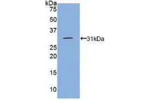 Western Blotting (WB) image for anti-Protein tyrosine Phosphatase, Receptor Type, J (PTPRJ) (AA 1061-1293) antibody (ABIN7440614)