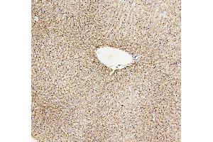 IHC analysis of GUSB using anti-GUSB antibody (ABIN7599854). (Glucuronidase beta Antikörper  (AA 122-575))