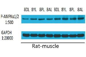 Western Blot (WB) analysis: Please contact us for more details. (PRKAA1/PRKAA2 Antikörper  (pThr172, pThr183))