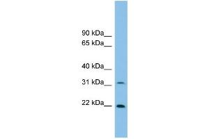 WB Suggested Anti-Foxn2 Antibody Titration: 0. (FOXN2 Antikörper  (N-Term))
