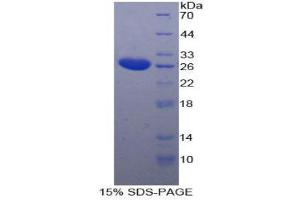 SDS-PAGE (SDS) image for Tubulin Polymerization Promoting Protein (Tppp) (AA 8-210) protein (His tag) (ABIN2127120)