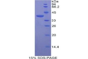 SDS-PAGE analysis of Mouse Centaurin alpha 2 Protein.