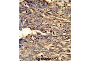 Immunohistochemistry (IHC) image for anti-Hemoglobin, alpha 2 (HBa2) antibody (ABIN2932211) (HBa2 Antikörper)