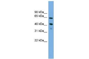 WB Suggested Anti-ATP8B2 Antibody Titration:  0. (ATP8B2 Antikörper  (N-Term))