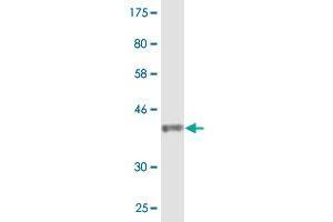 Western Blot detection against Immunogen (36. (CACNA2D2 Antikörper  (AA 65-162))