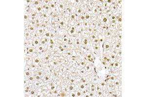 Immunohistochemistry (IHC) image for anti-Mucin 2, Oligomeric Mucus/gel-Forming (MUC2) (AA 4850-4950) antibody (ABIN7268690)