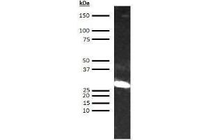 Western Blotting (WB) image for anti-alpha 1 Microglobulin/bikunin precursor (AMBP) antibody (ABIN613729) (AMBP Antikörper)