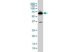 PCK1 monoclonal antibody (M01), clone 3E4 Western Blot analysis of PCK1 expression in HepG2 .