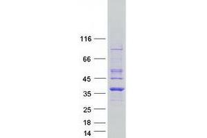 Western Blotting (WB) image for Pyrroline-5-Carboxylate Reductase 1 (PYCR1) (Transcript Variant 2) protein (Myc-DYKDDDDK Tag) (ABIN2730199)