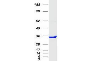 Validation with Western Blot (C21orf59 Protein (Myc-DYKDDDDK Tag))