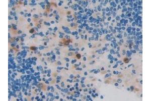 Immunohistochemistry (IHC) image for anti-Eosinophil Cationic Protein (ECP) (AA 33-155) antibody (ABIN7441835)