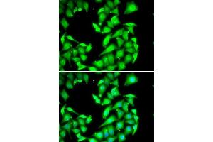 Immunofluorescence analysis of HeLa cells using PPM1A antibody. (PPM1A Antikörper  (AA 1-382))